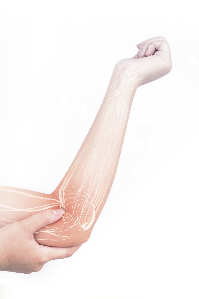 Ulnar Collateral Ligament Reconstruction