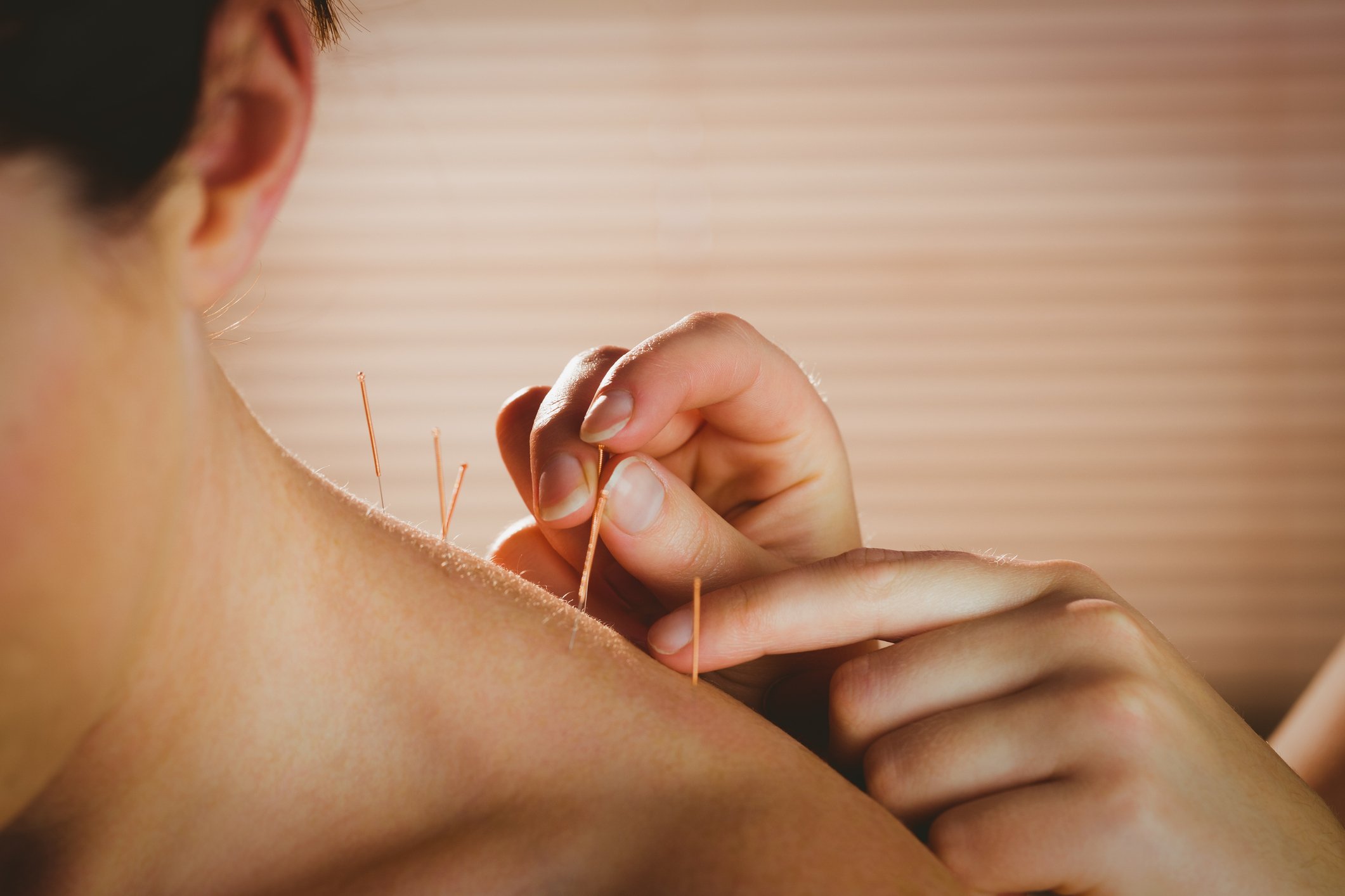 Watch Acupuncture for Rheumatoid Arthritis: What to Expect at Your First Visit video Watch Acupuncture for Rheumatoid Arthritis: What to Expect at Your First Visit video